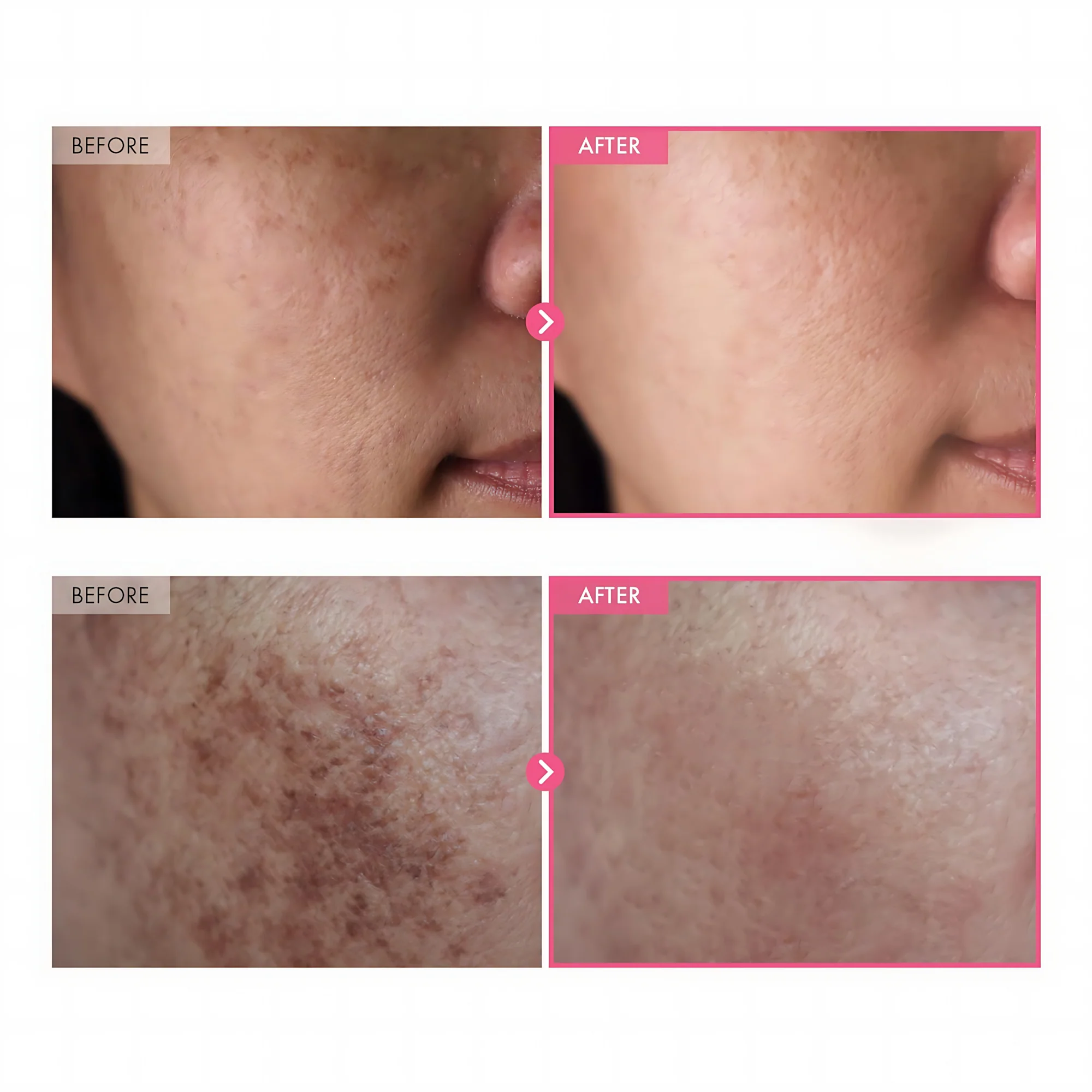 ACM Dépiwhite Advanced Intensive Anti-Brown Spot Cream – 40ml - Image 5