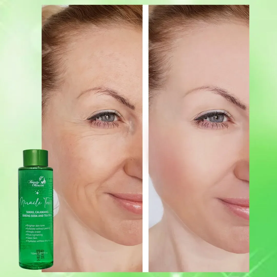 Beauty Obsession Miracle Toner - 150ml - Image 7
