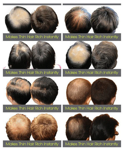 Dexe Hair Building Fibers Black No 1 - 22g - Image 6
