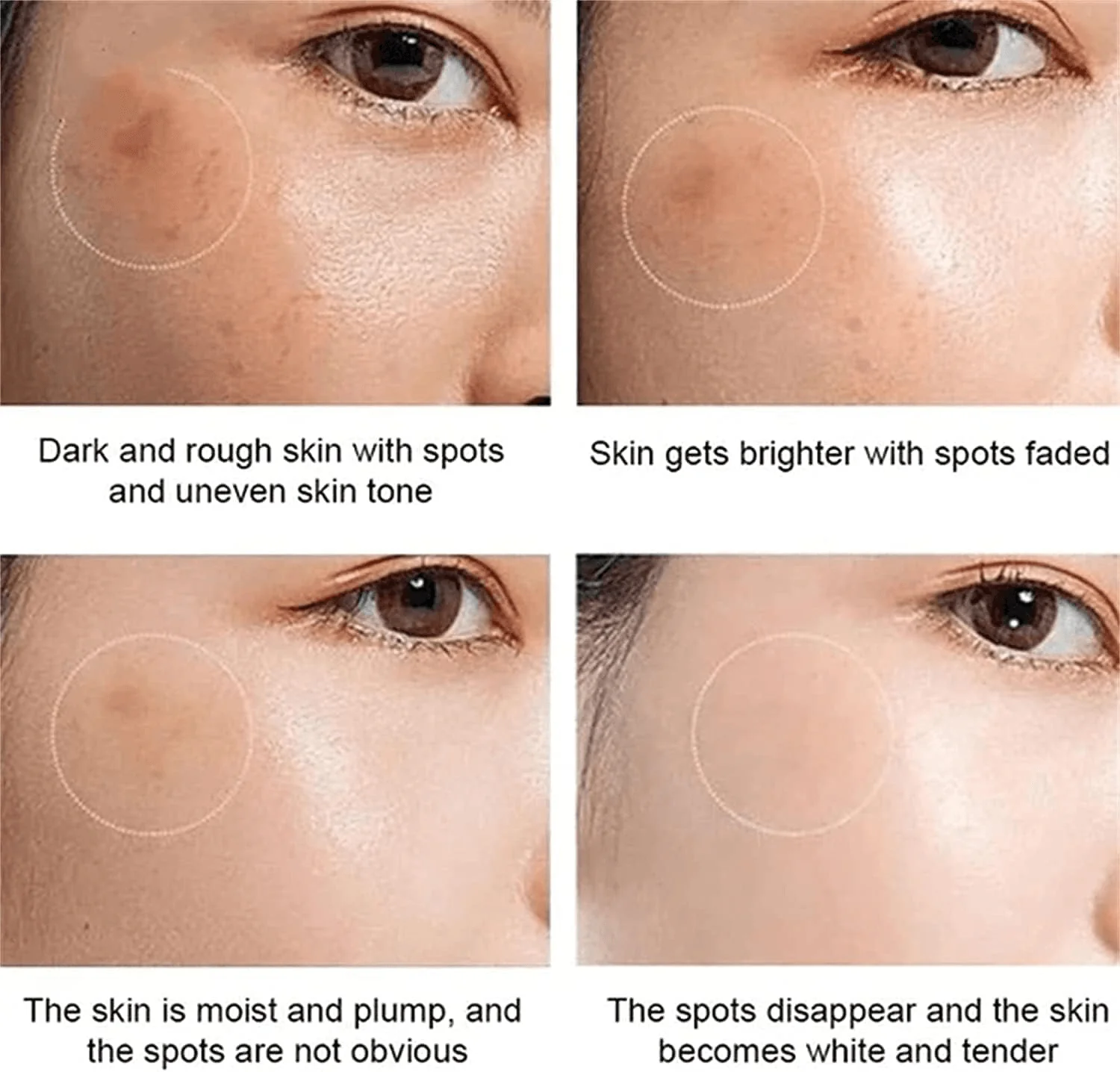 Dr Hancy White Spot Japan Cream - 20g - Image 9