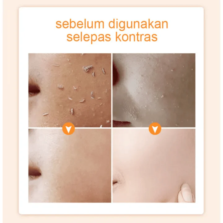 Gmeelan Orange Exfoliating Whitening Gel - 50g - Image 4