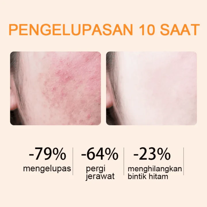 Gmeelan Orange Exfoliating Whitening Gel - 50g - Image 6