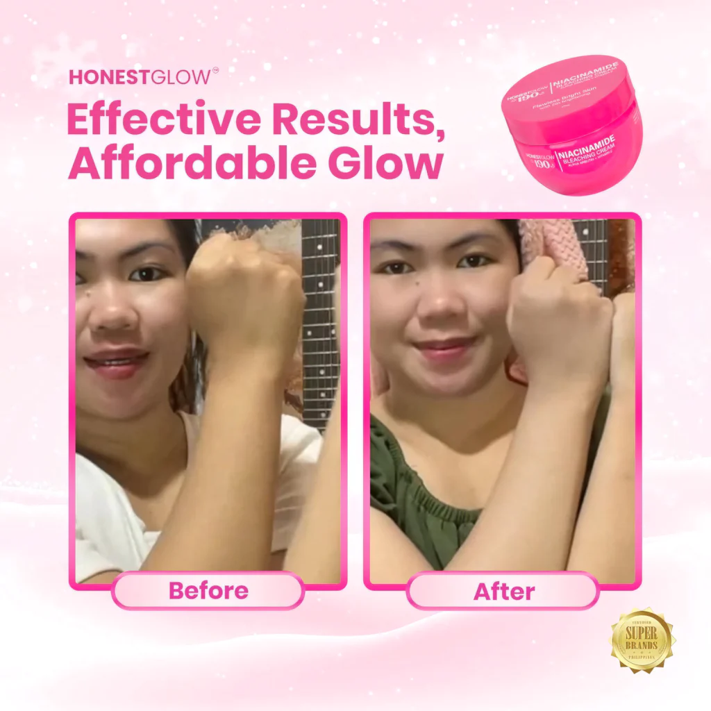 Honest Glow 190 – Niacinamide Bleaching Cream (250ML) - Image 4