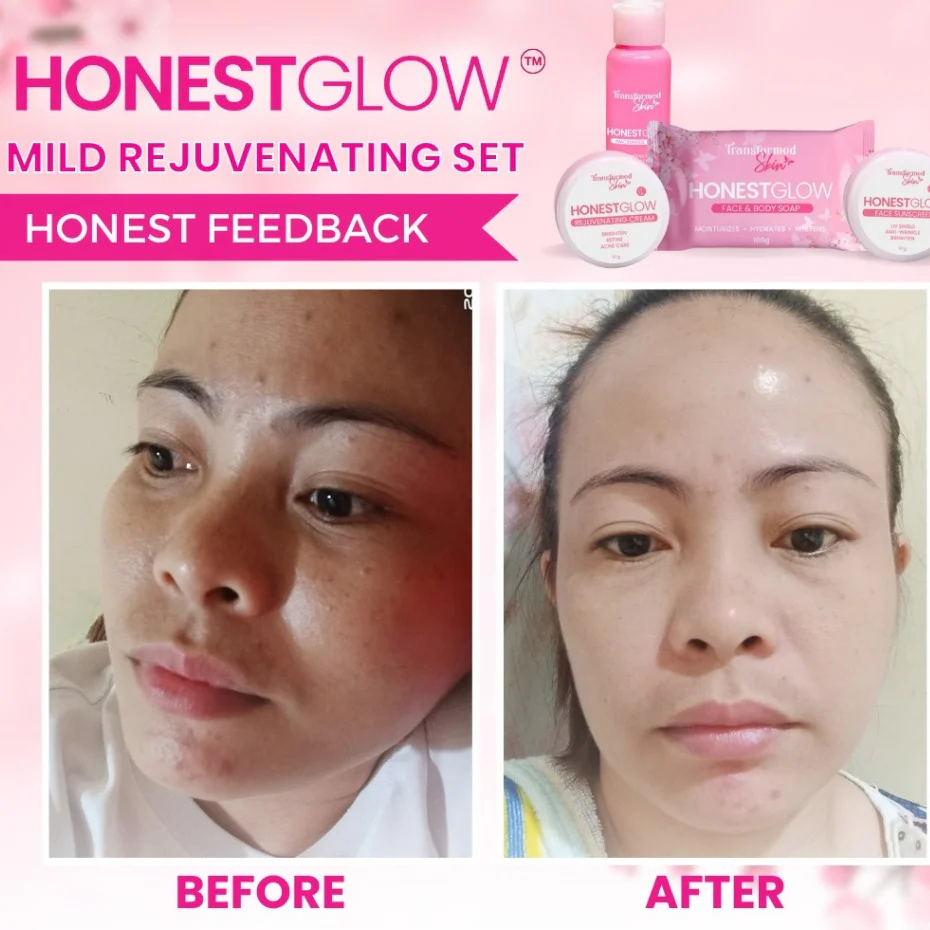 HonestGlow Facial Set Mild Rejuvenating Set - Image 13