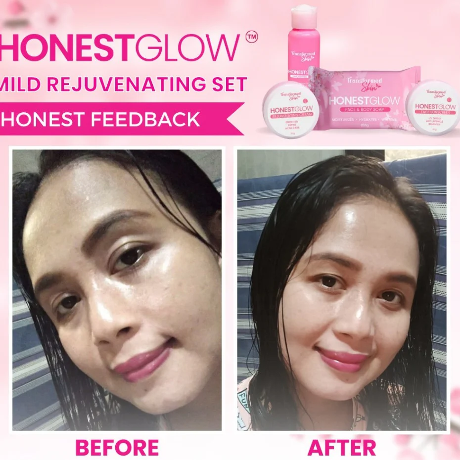 HonestGlow Facial Set Mild Rejuvenating Set - Image 15