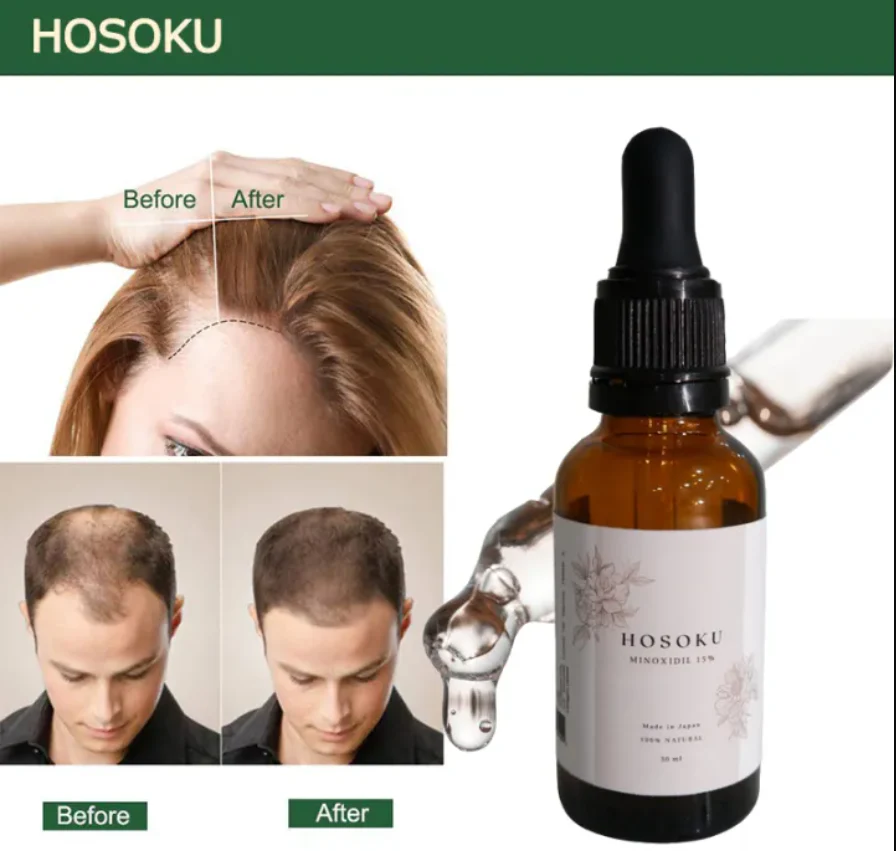 HOSOKU Minoxidil 15% Hair Regrowth Oil – 30ml - Image 2