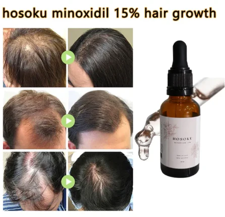 HOSOKU Minoxidil 15% Hair Regrowth Oil – 30ml - Image 6