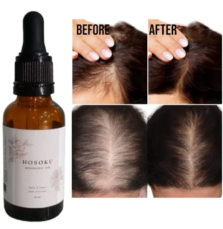 HOSOKU Minoxidil 15% Hair Regrowth Oil – 30ml - Image 9