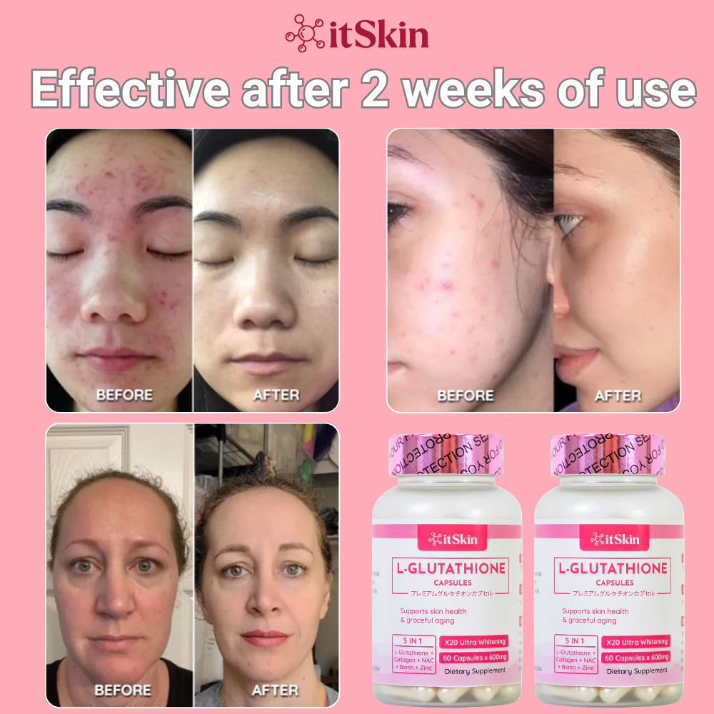 It Skin L-Glutathione - Image 5