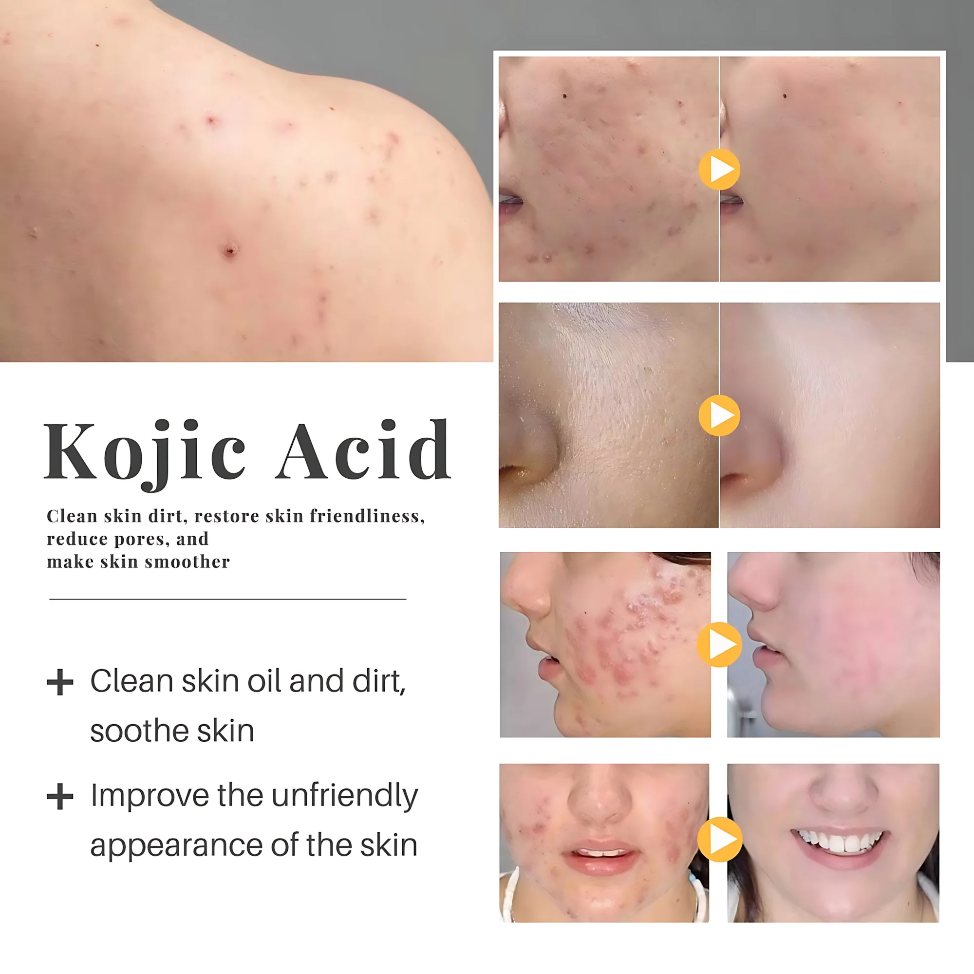 K88 Kojic Niacinamide Soap – Skin Brightening & Even-Tone Formula (70g) - Image 7
