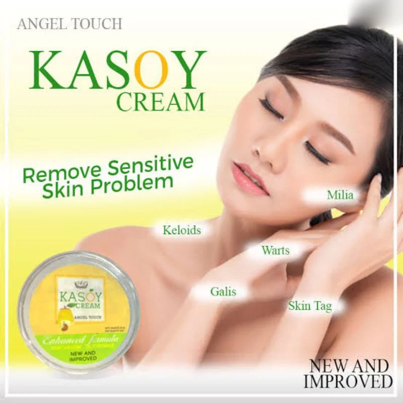 Kasoy Cream Warts Remover Angel Touch - 5g - Image 2