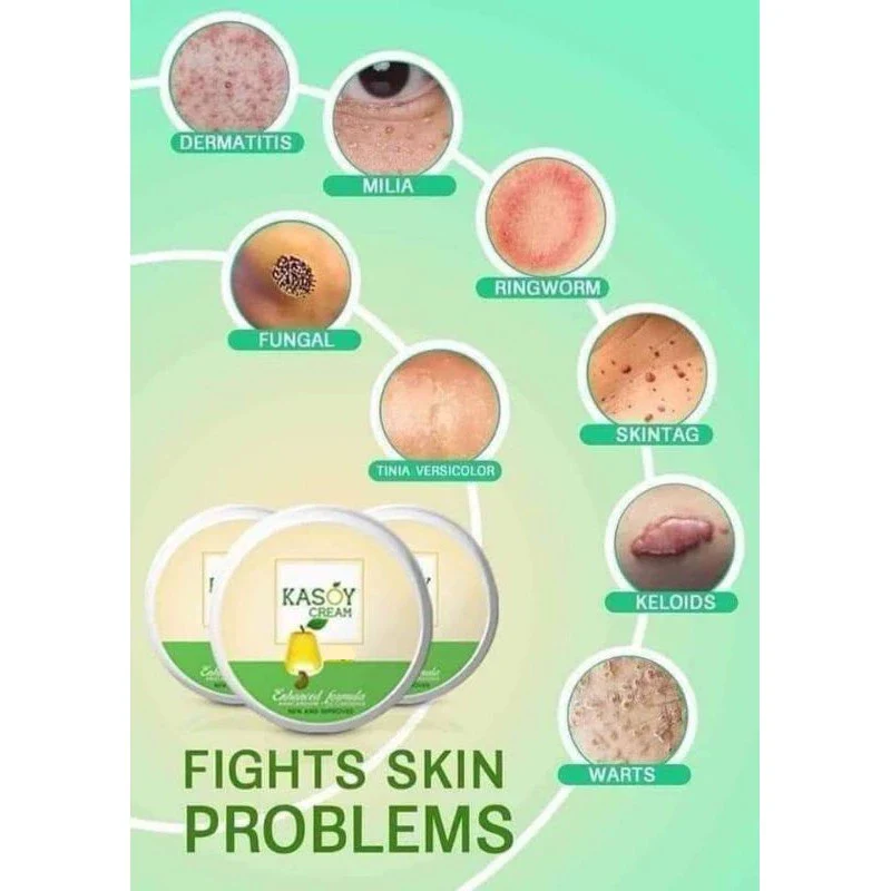 Kasoy Cream Warts Remover Angel Touch - 5g - Image 3