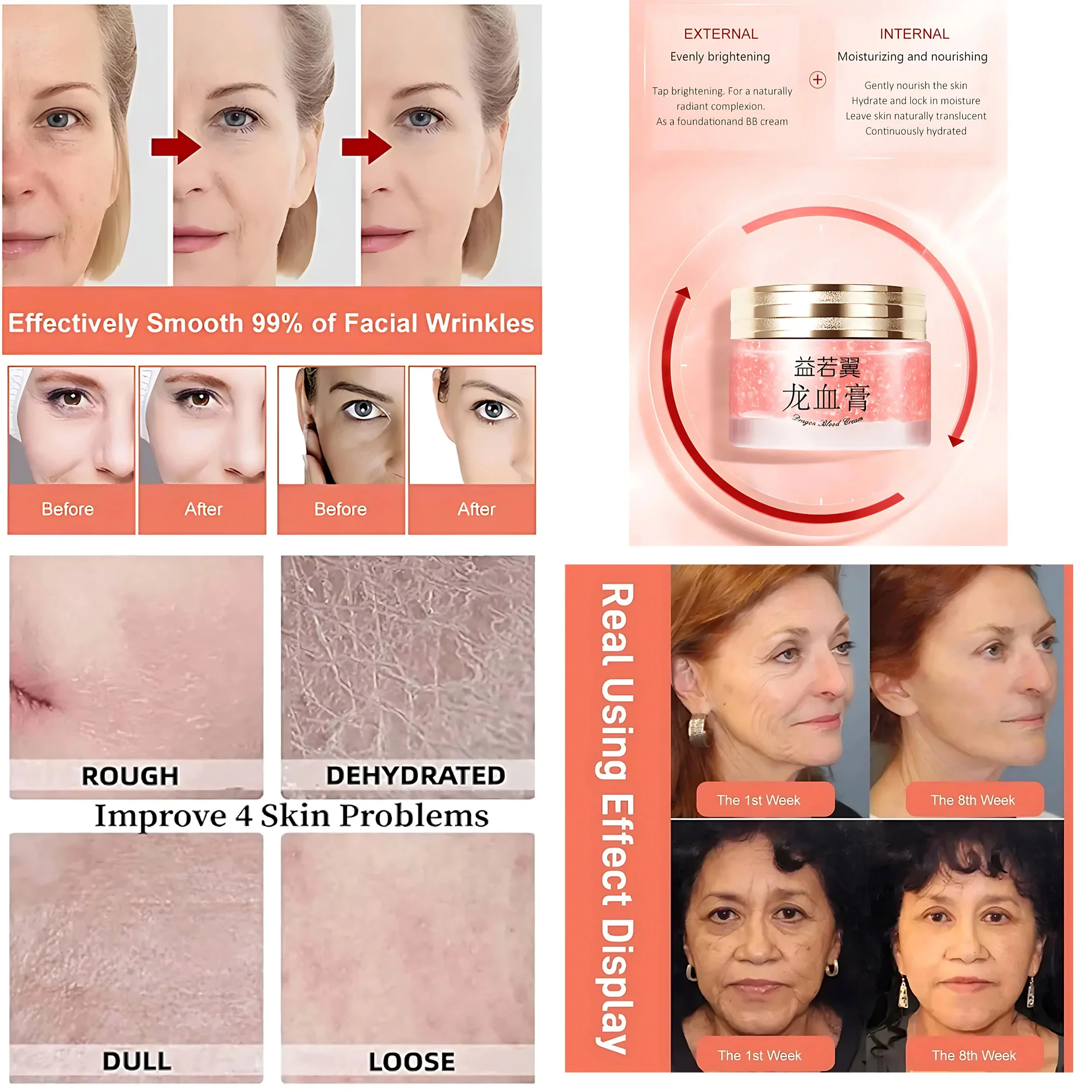 Kniyea VC Toner + Sadoer Niacinamide + Kiss Beauty Sunscreen + Retinol Placenta Royal Dragon Blood Cream – 4in1 Combo Set - Image 3
