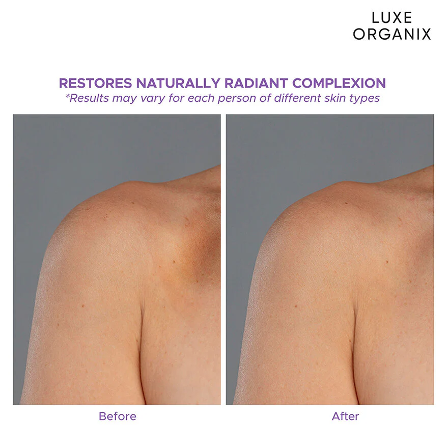 Luxe Organix Retinol + Gluta Youthful Radiance Whitening Serum Lotion - 350ml - Image 8