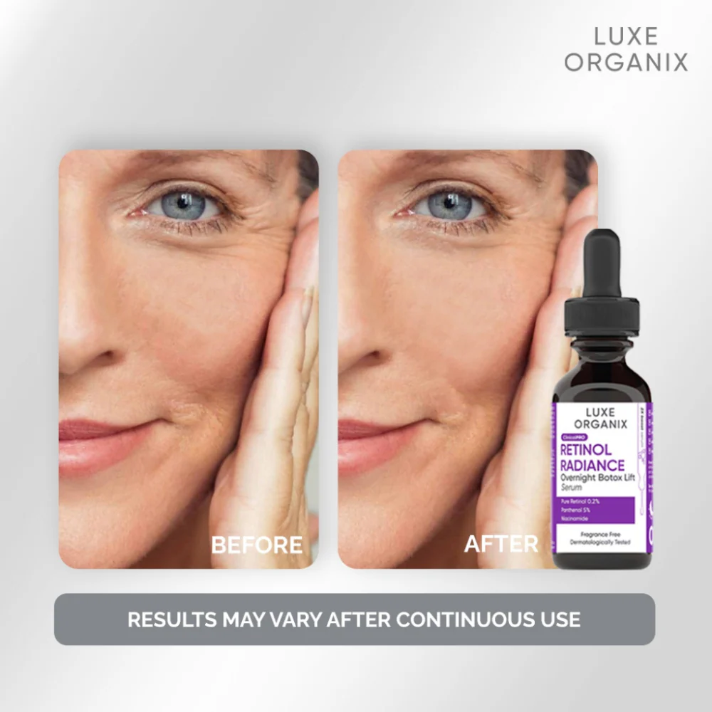 Luxe Organix Retinol Radiance Overnight Botox Lift Serum - 30ml - Image 7