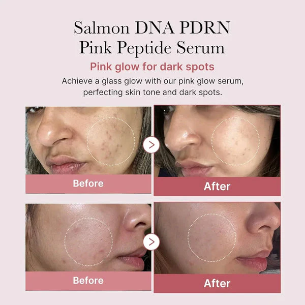 Medicube PDRN Pink Peptide Serum - 30ml - Image 3