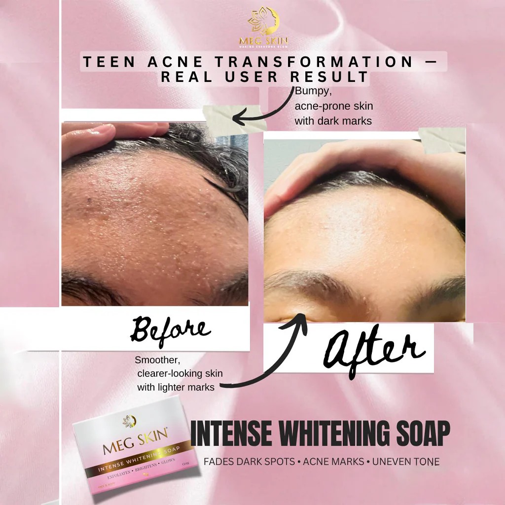 MEG SKIN Intense Whitening Soap – 150g (BUY 1 GET 1 OFFER) - Image 4