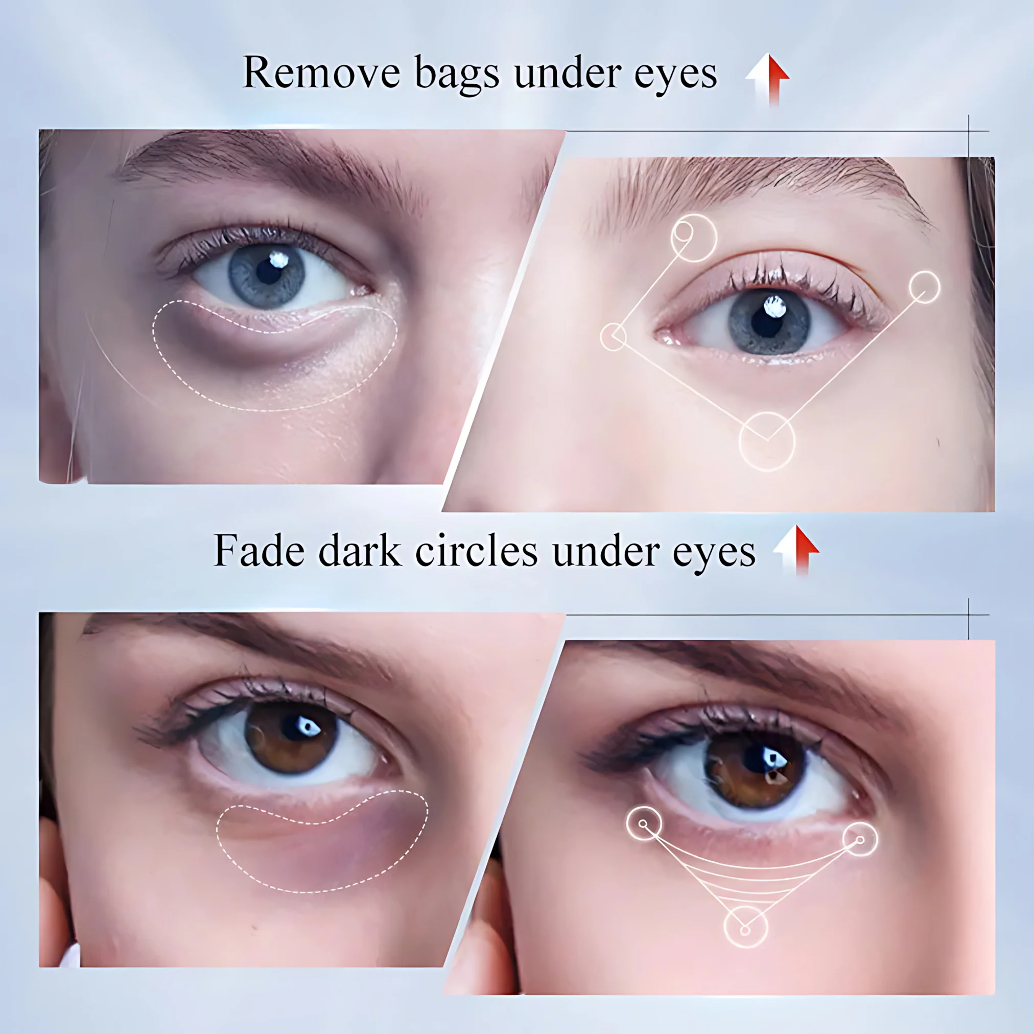 Sadoer Kojic Acid Whitening Freckles Eye Cream – 20g - Image 4