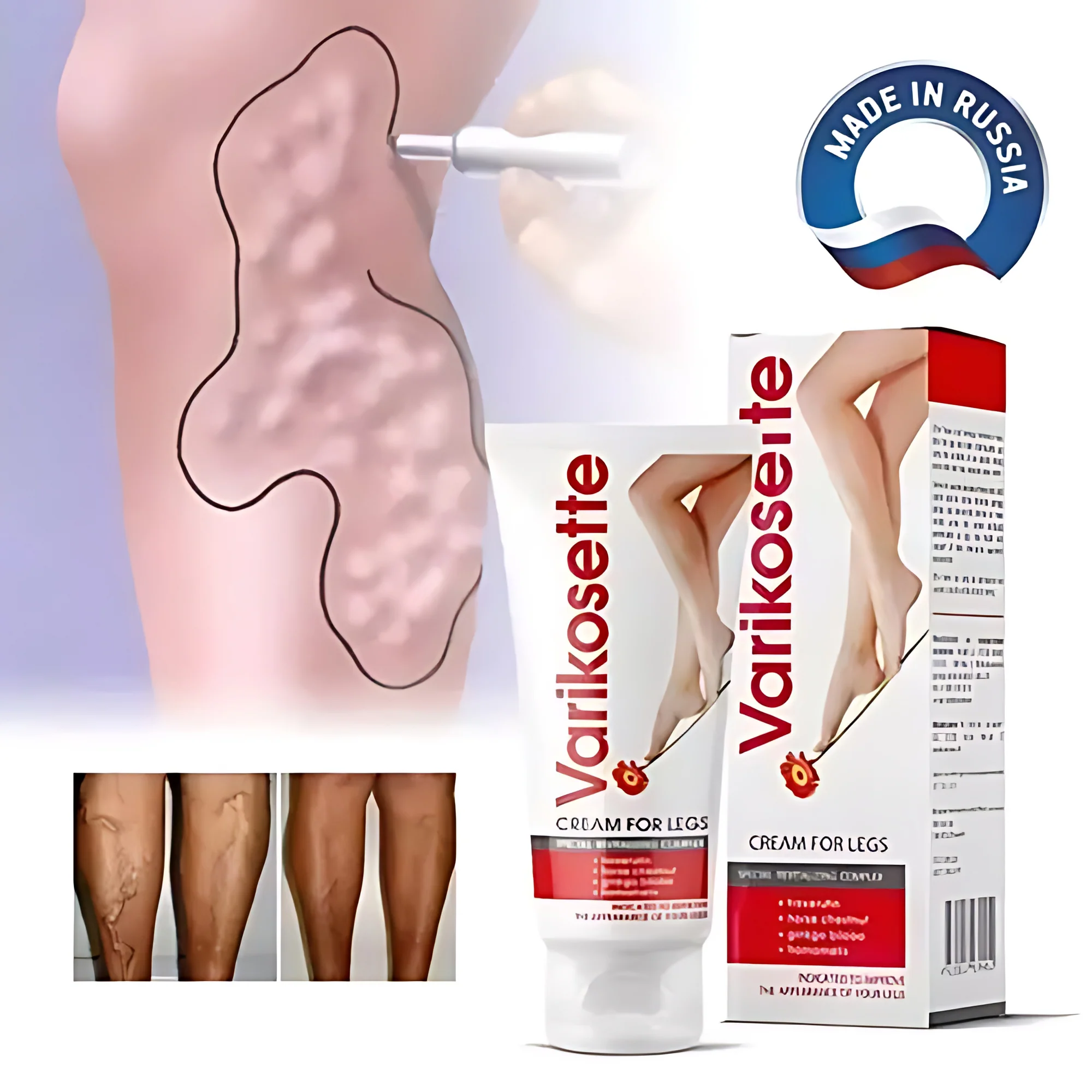 Varikosette Cream for Legs - 75ml - Image 5