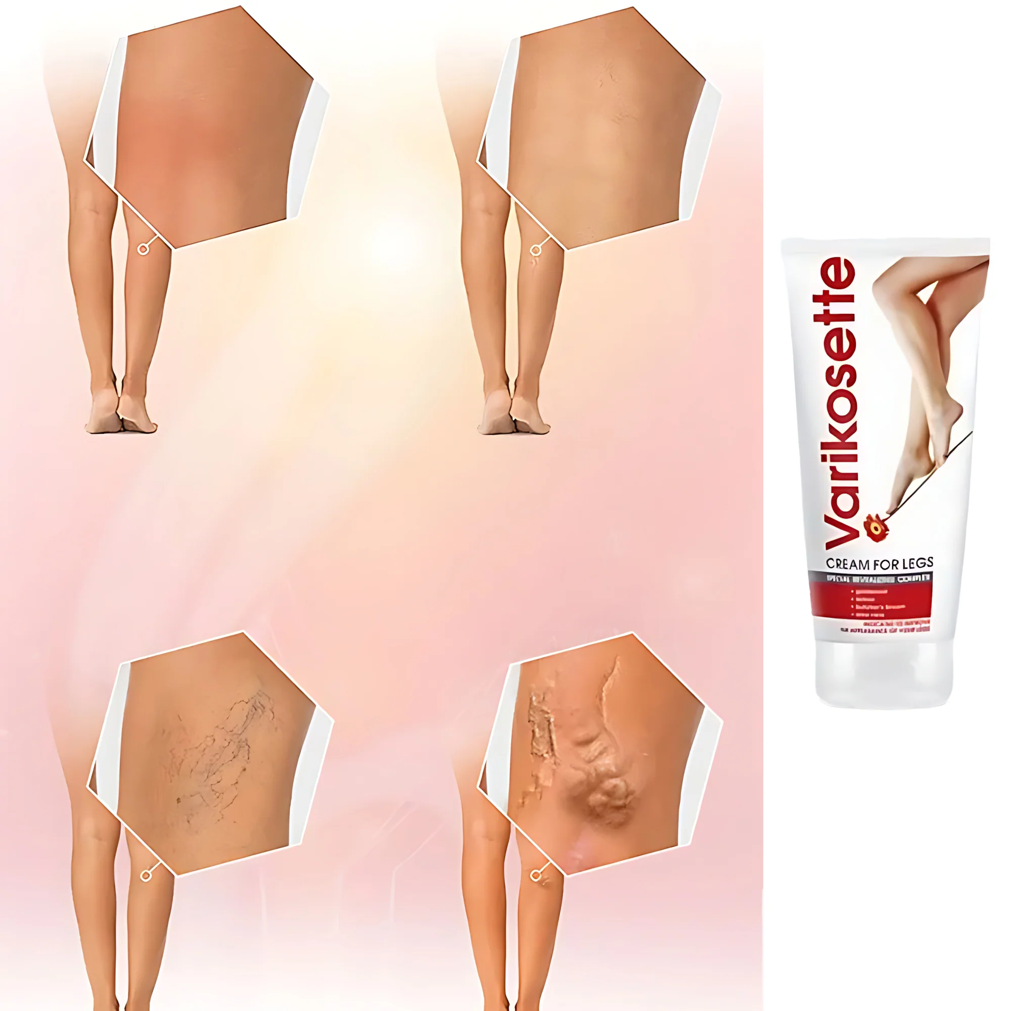 Varikosette Cream for Legs - 75ml - Image 8