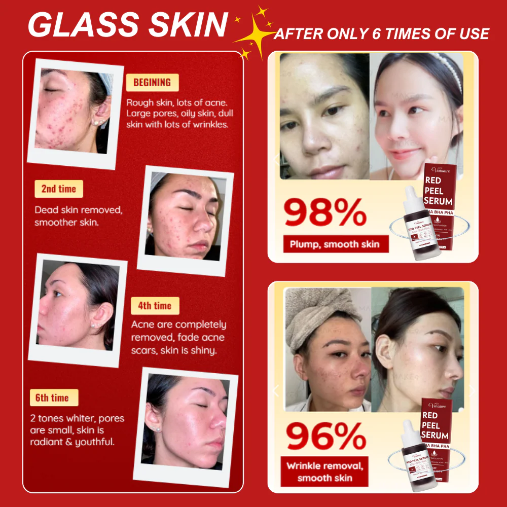 Venature Red Peel Serum - 20ml - Image 7